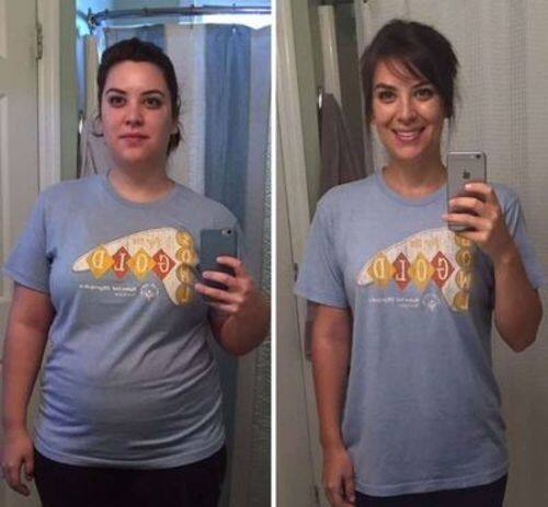 Meias medicinais AFIZ para emagrecimento dos gânglios linfáticos da turmalina