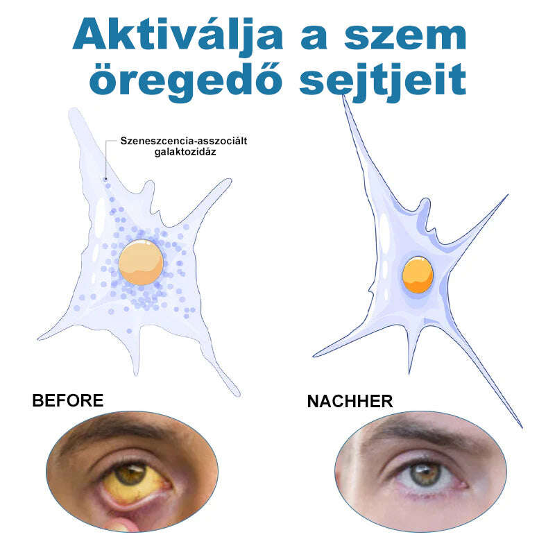 👁️Ouryard™ colírio para tratar problemas de visão