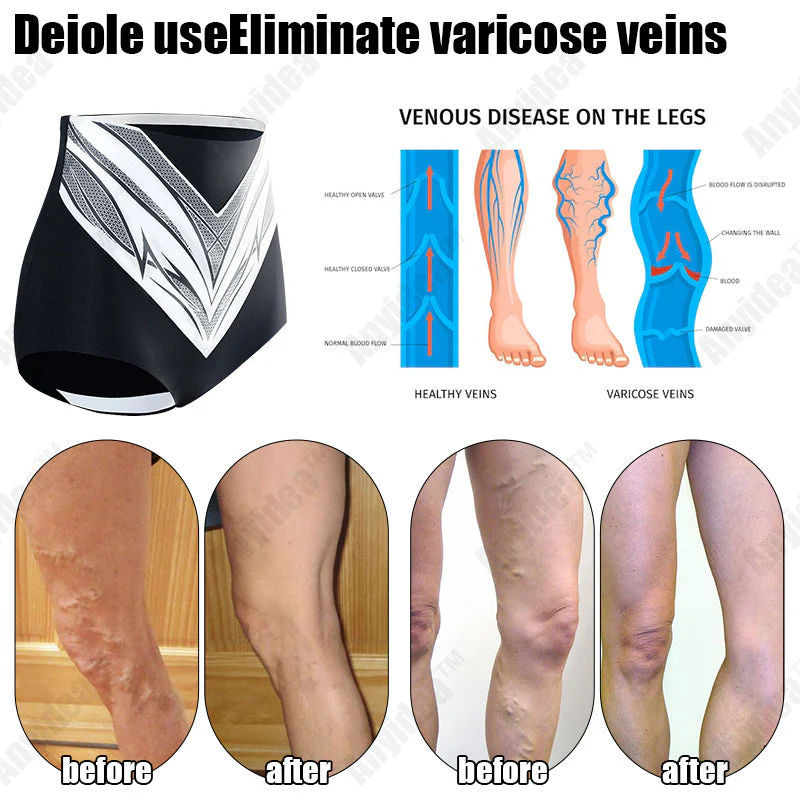 Shorts modeladores de turmalina autoaquecidos de fibra de titânio de grau médico 🔥