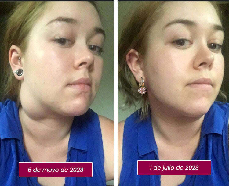 OVEALLGO™ LUNA ОБЕЦИ LYMPHVITY GERMANIUM MAGNETOTHERAPY