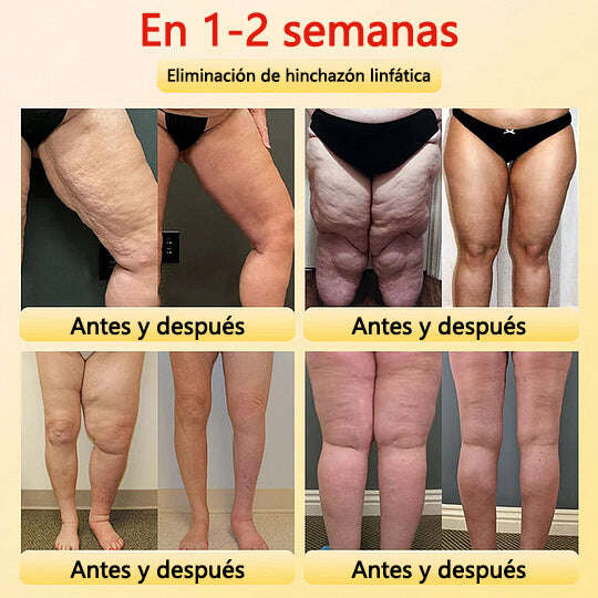 🎉 Oferta por tempo limitado – Grande desconto! 💰 Calções modeladores Anyidea™ de turmalina autorregulada com fibra de titânio