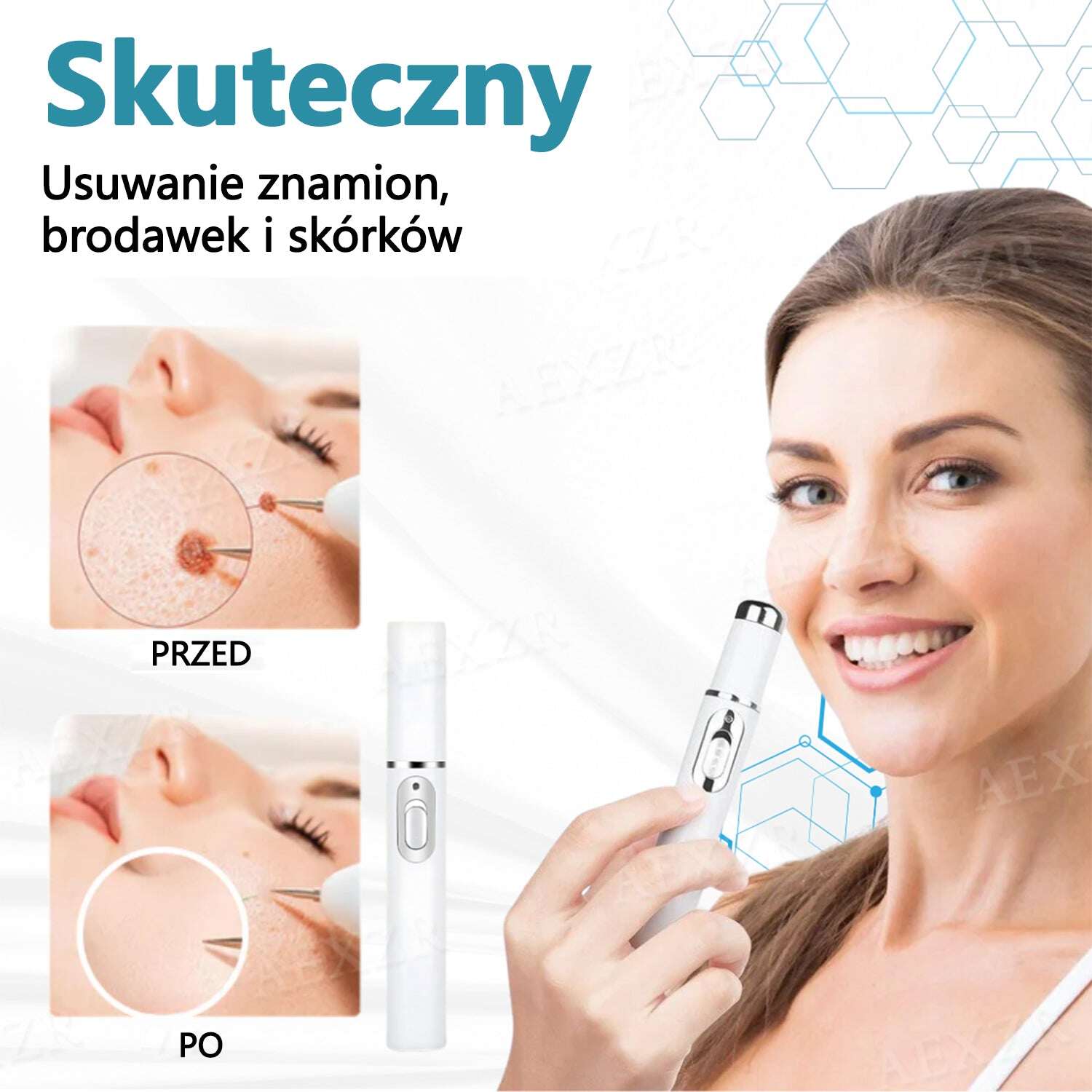 Cvreoz® új, nem invazív lézer anyajegyek és szemölcsök eltávolítására ✅