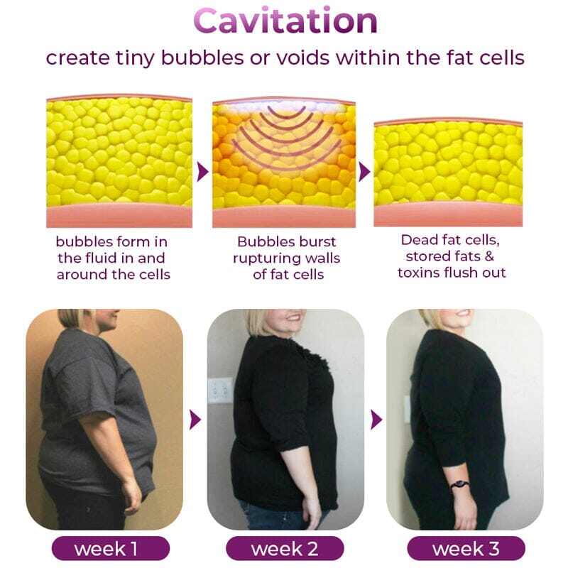 GFOUK™ ГРИВНА ЗА КОНТРОЛ НА ЗДРАВЕТО