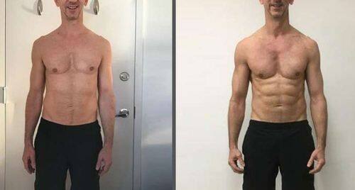 Meias medicinais AFIZ para emagrecimento dos gânglios linfáticos da turmalina