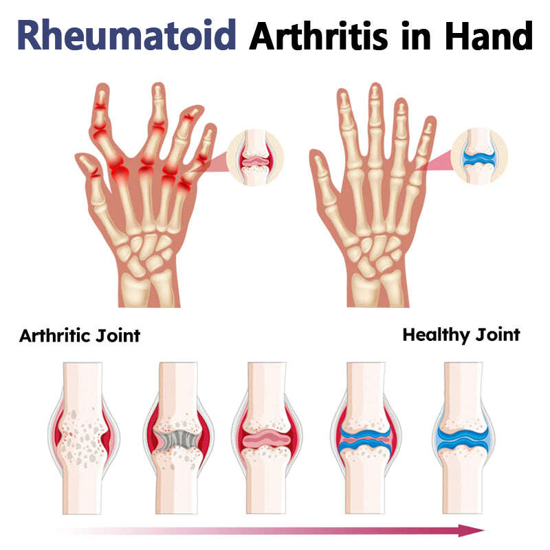 🐝BeeZen™ New Zealand Bee Venom Joint & Bone Therapy Joint Therapy Cream 🎉Oferta especial de ano novo🐝