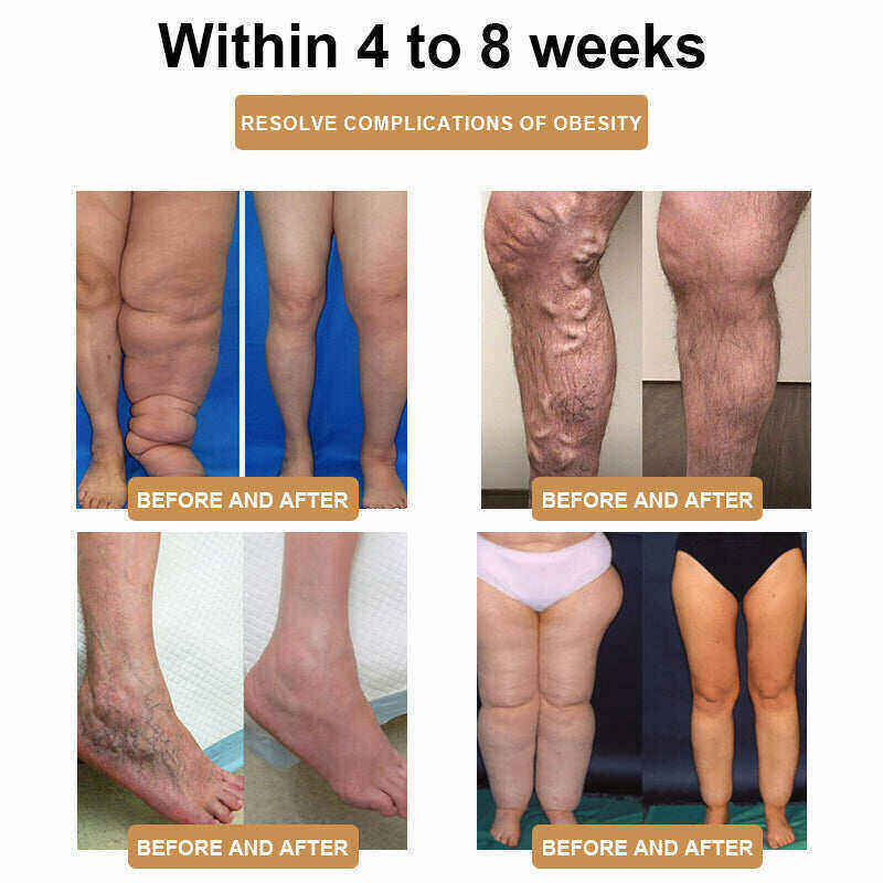 💪 Най-новата гривна SlimPulseTM 2024 за ултразвукова струя и детоксикация на мазнини - енергиен баланс 🎁 (отстъпка за ограничено време + препоръка от лекар)