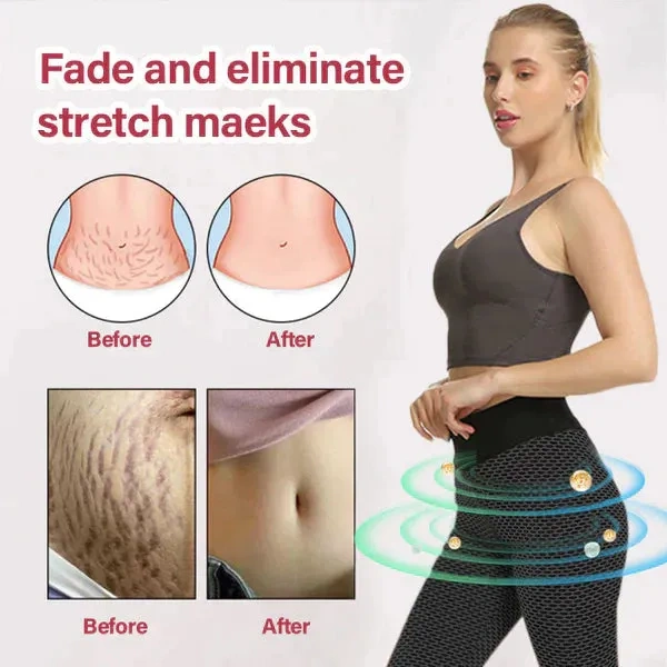 Novas roupas modeladoras de iões Fivfivgo™ 2025