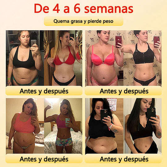 🎉 Oferta por tempo limitado – Grande desconto! 💰 Calções modeladores Anyidea™ de turmalina autorregulada com fibra de titânio