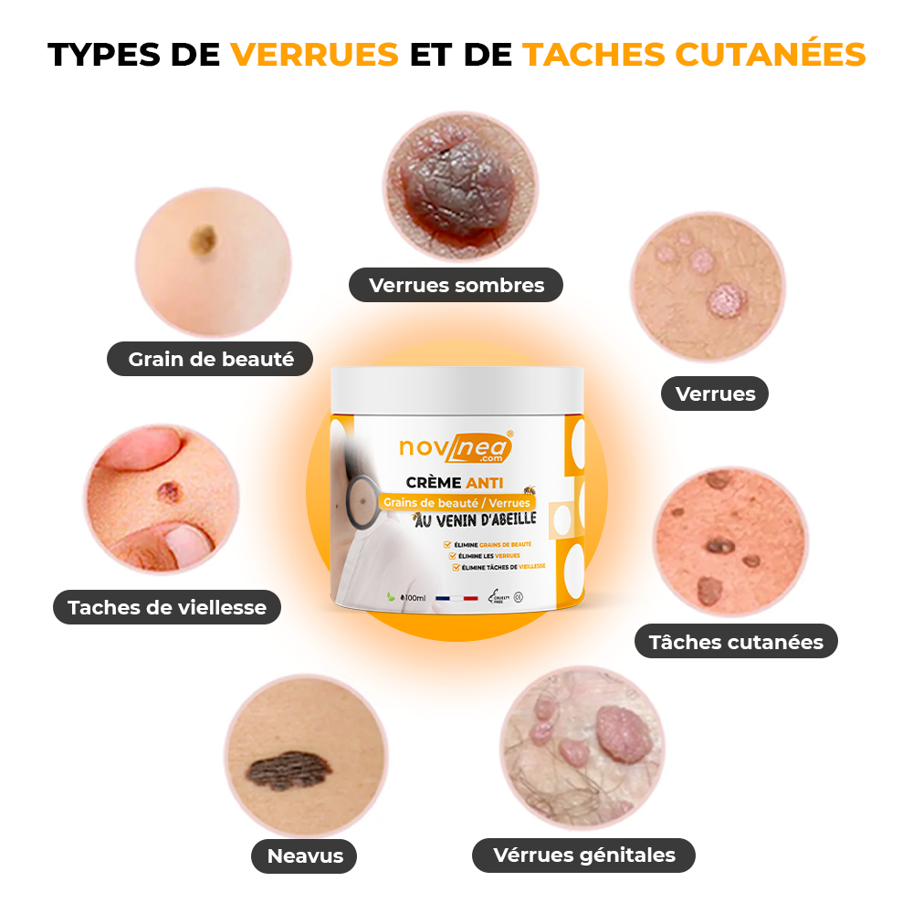 Creme anti-verrugas e verrugas com veneno de abelha