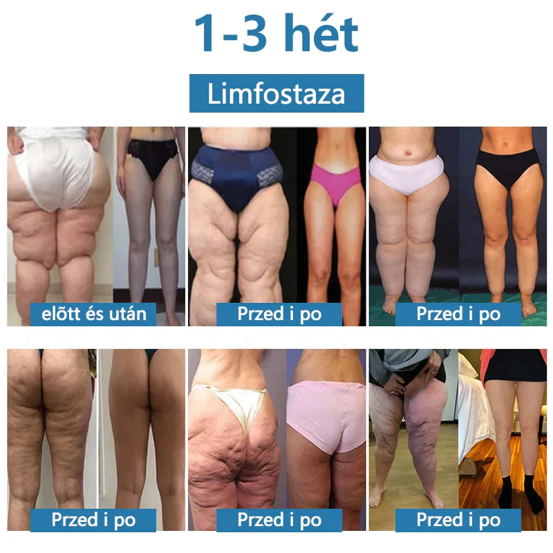 SIENOVATM💎 Dispositivo portátil para drenagem linfática e relaxamento articular👨‍⚕️ Terapia 2 em 1 original