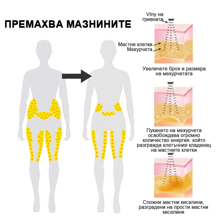 ✨🩵2024 Най-новата RicheranTM Ултразвукова детоксикираща гривна за изгаряне на мазнини-енергиен баланс⏱️ (70% отстъпка през последните няколко дни + препоръчано от лекар)