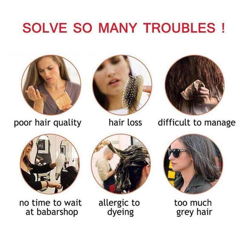 HOT SALE🔥 49% OFF|Top Peças de Peruca