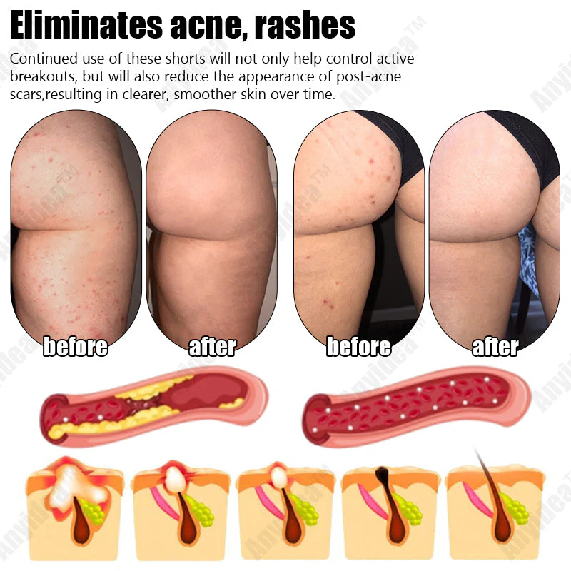 Shorts modeladores de turmalina autoaquecidos de fibra de titânio de grau médico 🔥