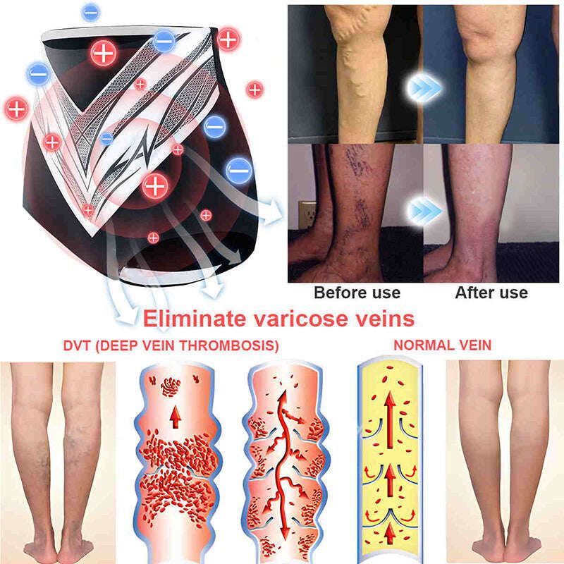 Últimas 3 horas: 80% DE DESCONTO 🔥 Shorts modeladores de turmalina autoaquecidos em fibra de titânio Neslemy™