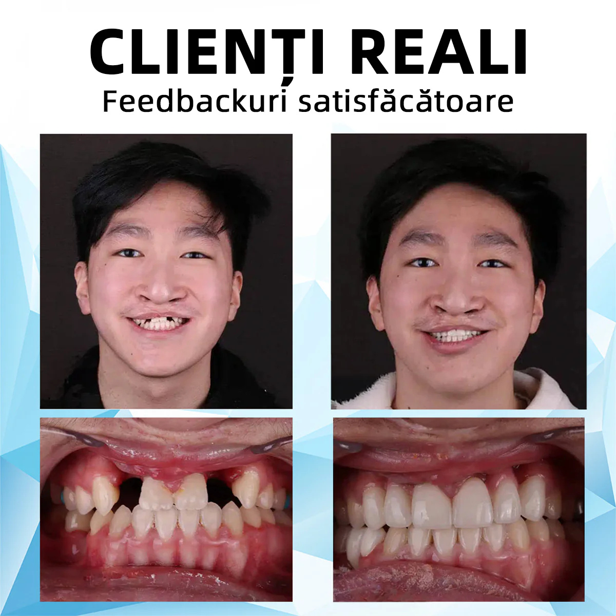 Recomendado por dentistas Bikenda