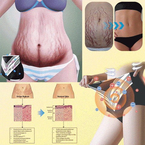 【ILF R&D】PaURAJU™ Магнитни турмалинови оформящи шорти ❤️ Голяма новогодишна разпродажба 40%