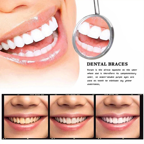 SMILEKITTM Nova série V34 creme dental corretor de cor roxa