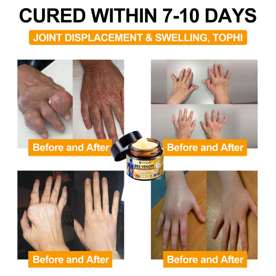 Fivfivgo™ Bee Venom Instant Ultra Strength Pain Relief Therapy Cream (Elimina a dor para artrite, dores musculares, nas costas, joelhos, costas, ombros, quadris, pulsos, mãos)