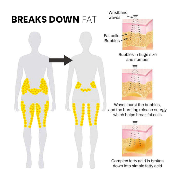 (🔥ПОСЛЕДНИЯ ДЕН 70% ОТСТЪПКА) ULTRASONIC BODY SHAPE WRISTBAND PRO）