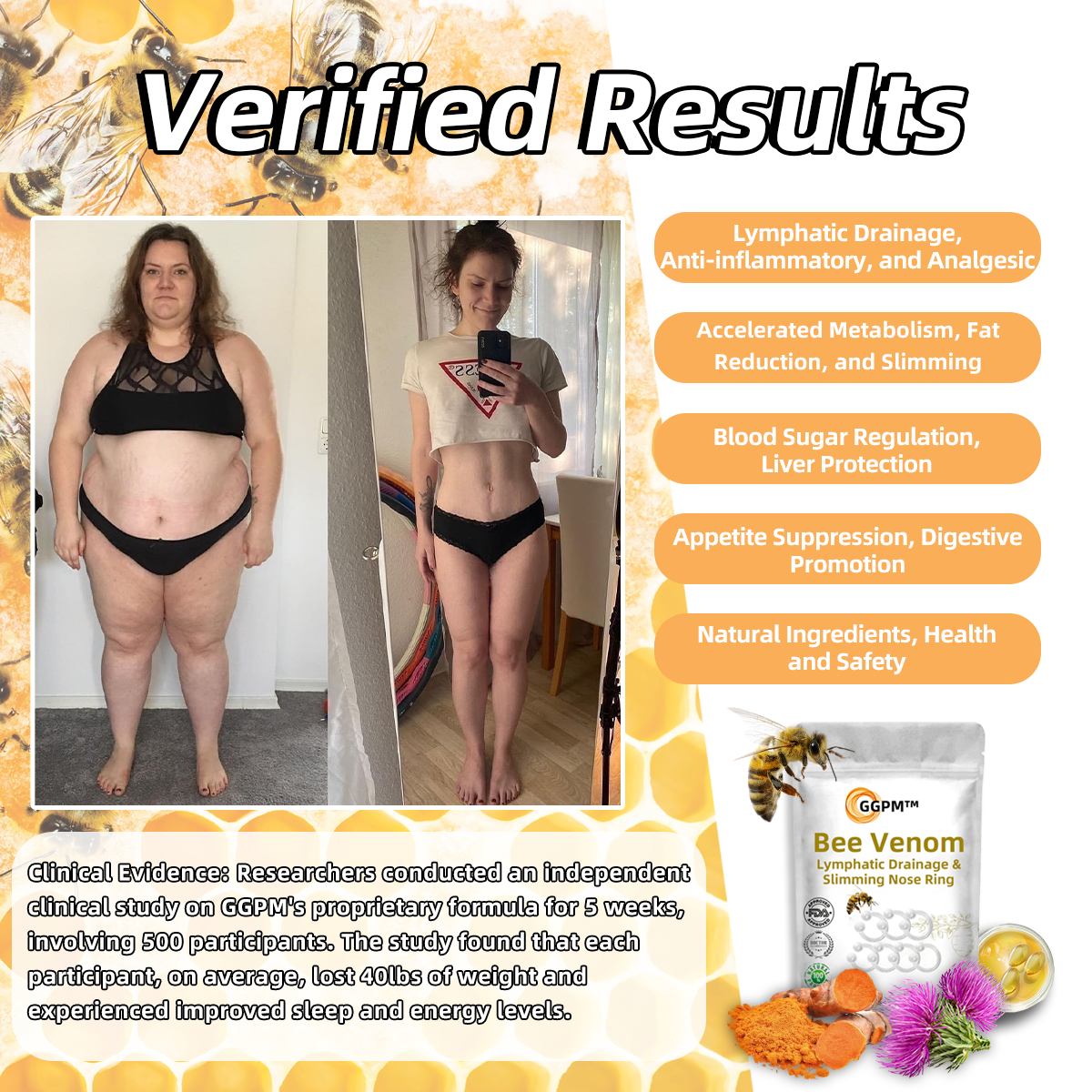 💖𝐆𝐆𝐏𝐌™ 𝐁𝐞𝐞 𝐕𝐞𝐧𝐨𝐦 𝐋𝐲𝐦𝐩𝐡𝐐𝝐𝐢𝐐 𝐞 & 𝐒𝐥𝐢𝐦𝐦𝐢𝐧𝐠 𝐍𝐨𝐬𝐞 𝐑𝐢𝐧𝐠⭐ (para todos os problemas linfáticos e obesidade)