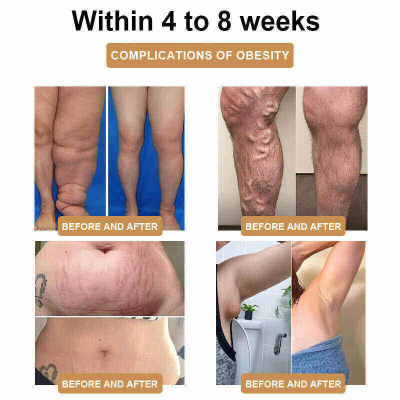 💪 Най-новата гривна SlimPulseTM 2024 за ултразвукова струя и детоксикация на мазнини - енергиен баланс 🎁 (отстъпка за ограничено време + препоръка от лекар)