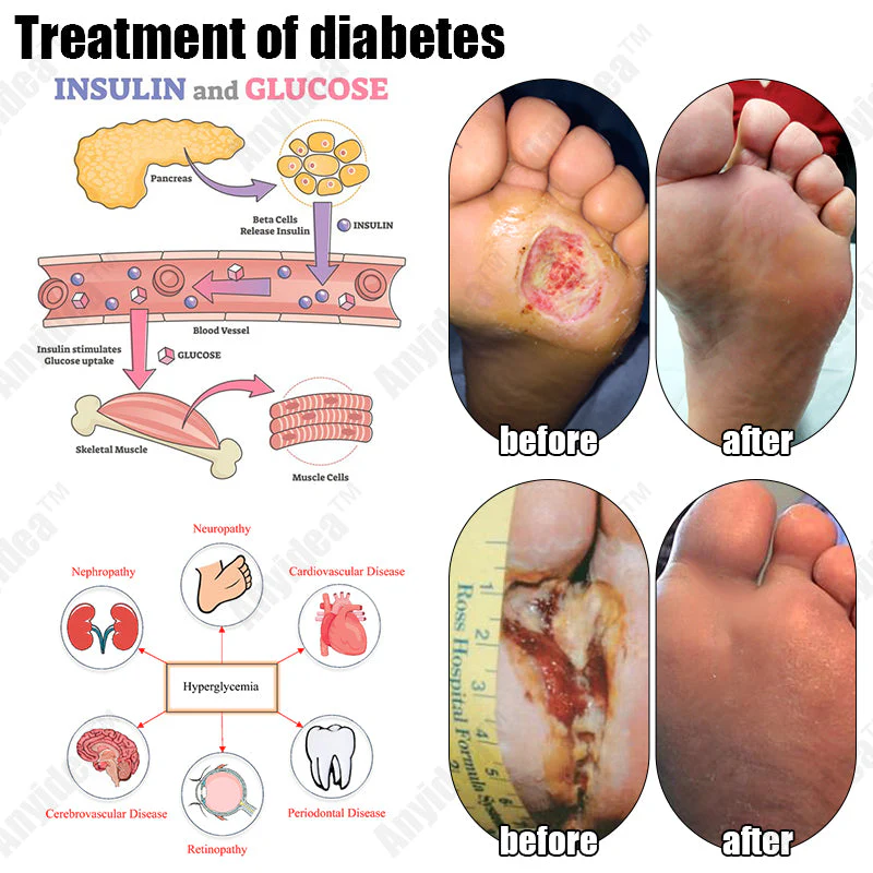 Shorts modeladores de turmalina autoaquecidos de fibra de titânio de grau médico 🔥