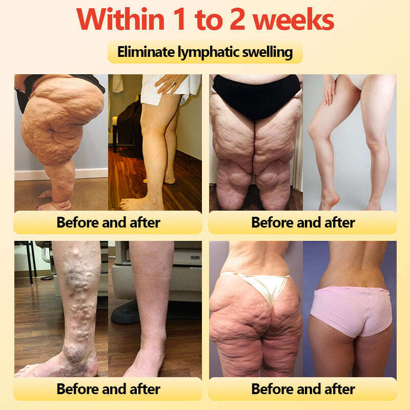 【ILF R&D】PaURAJU™ Магнитни турмалинови оформящи шорти ❤️ Голяма новогодишна разпродажба 40%