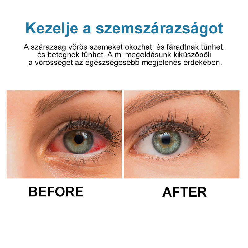 👁️Ouryard™ colírio para tratar problemas de visão