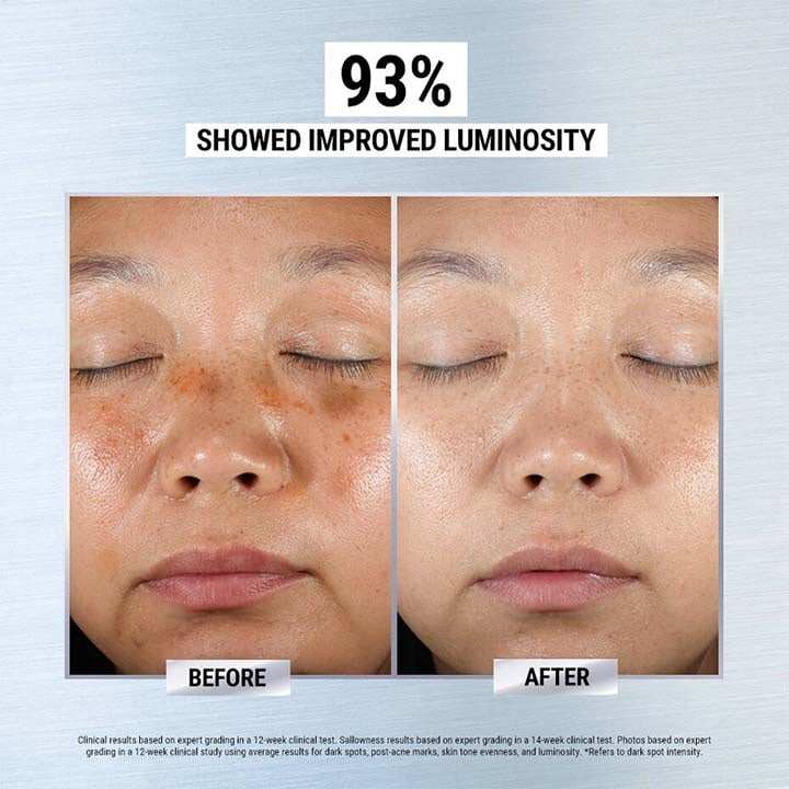 Sérum Antioxidação de Cúrcuma