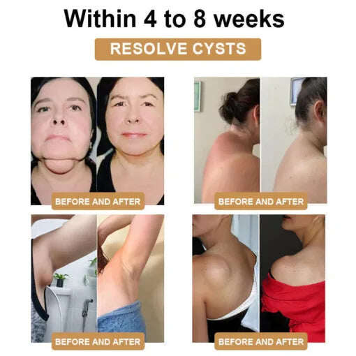 Pulseira Ultrassônica Detox e Detox Fivfivgo™ - Equilíbrio Energético