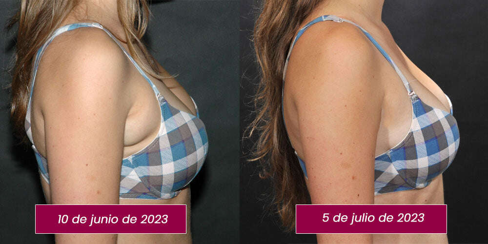 OVEALLGO™ LUNA ОБЕЦИ LYMPHVITY GERMANIUM MAGNETOTHERAPY