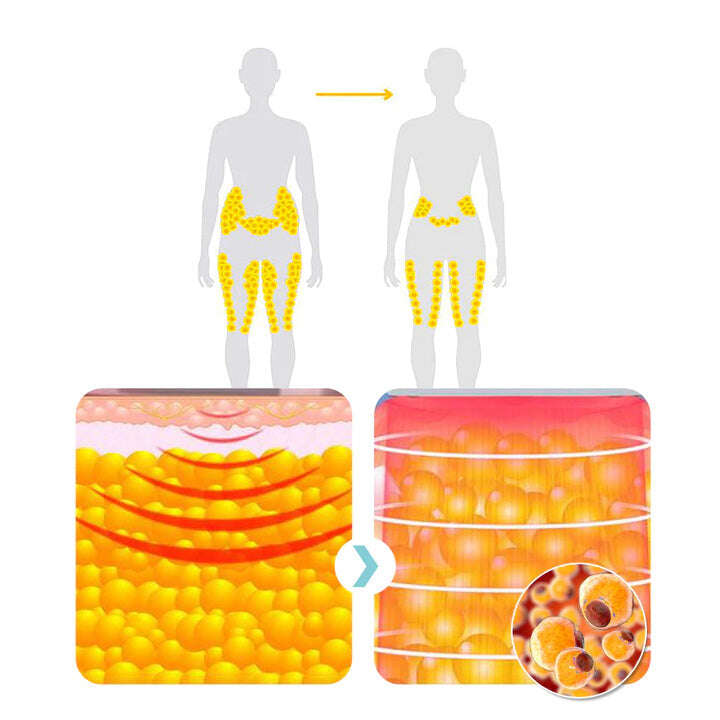 (🔥ПОСЛЕДНИЯ ДЕН 70% ОТСТЪПКА) ULTRASONIC BODY SHAPE WRISTBAND PRO）