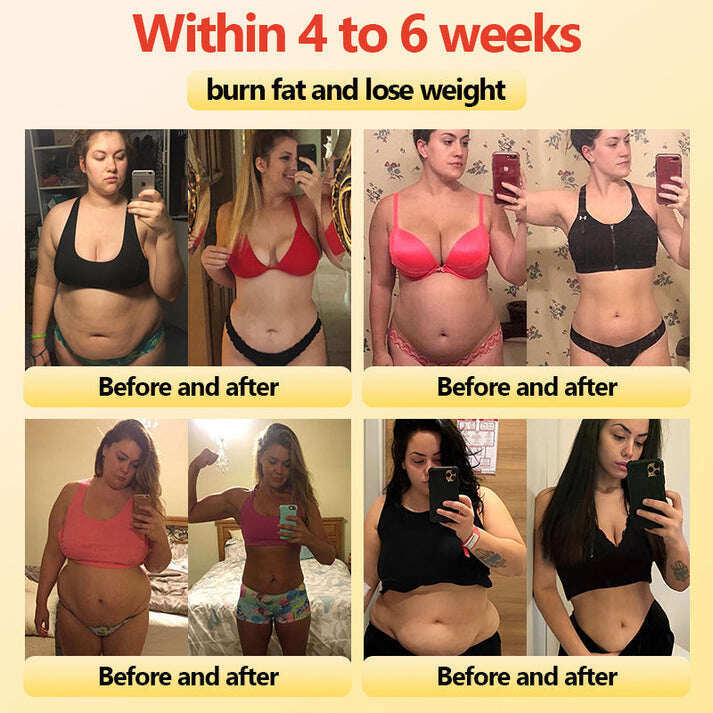 🎉 Предложение за ограничено време - Голяма отстъпка! 🔥 До 90% ОТСТЪПКА! 💰 Къси панталони с турмалиново оформящо облекло Sfrcord™ от титанови влакна✅✅