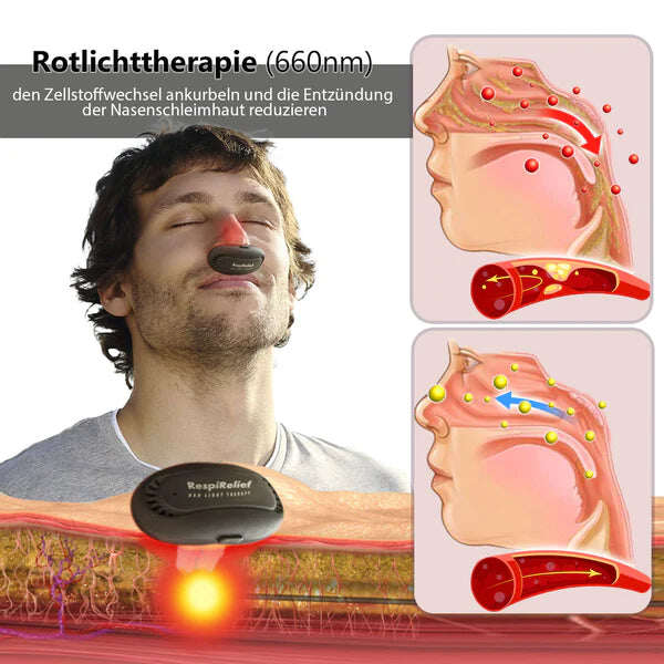 Dispositivo de terapia nasal Oveallgo™ INSTANT RespiRelief com luz vermelha