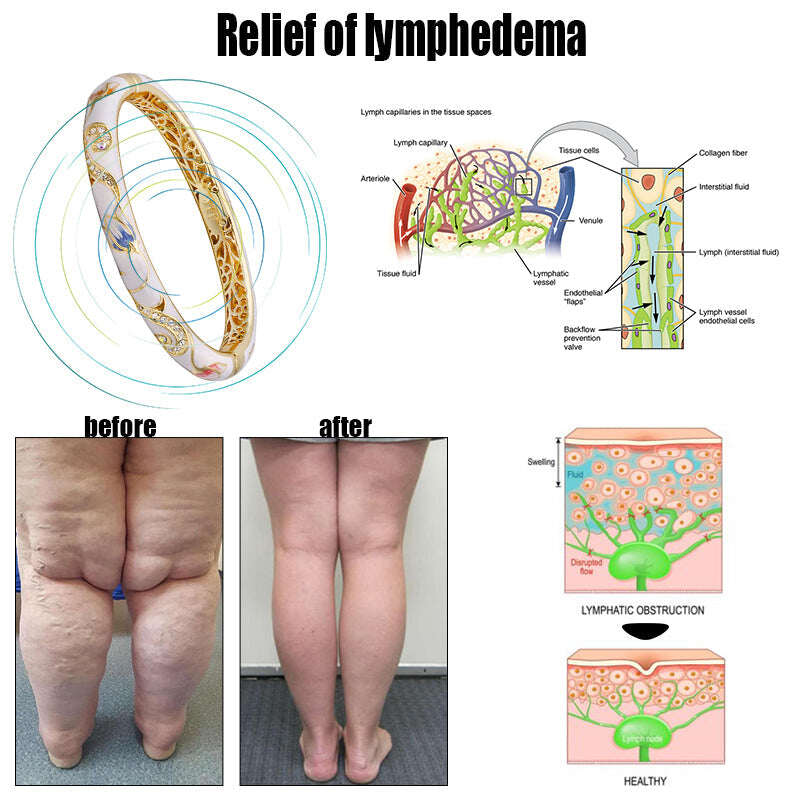 Routlets™🔥Pulseira de terapia magnética linfática💎