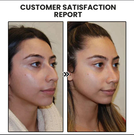 Brincos de argola para atividades linfáticas (promoção por tempo limitado 🔥 último dia)