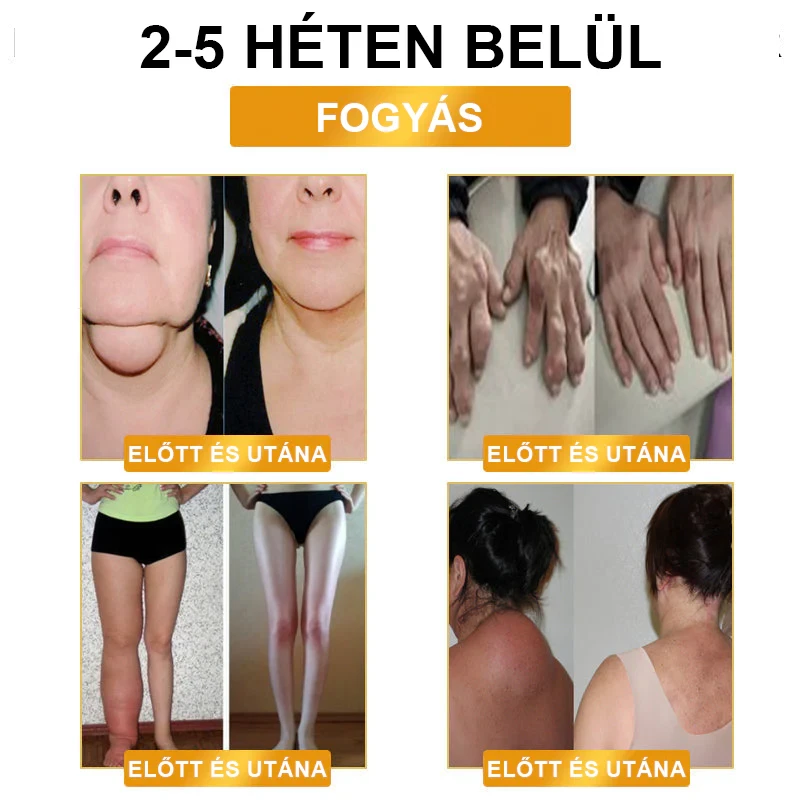 JOSFIT Ultradźwiękowa Liposukcja i Daleka Podczerwień Opaska Detox do Wyrównywania Poziomu Cukru We Krwi - Energy Balance Wyprzedaż Ograniczona Czasowo