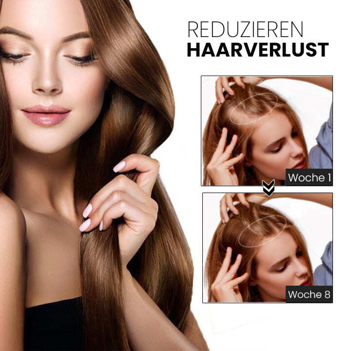 Spray de crescimento de cabelo japonês ShougaGRO