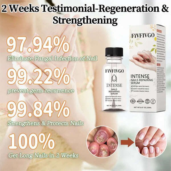 Fivfivgo™ NailGro Sérum Intenso de Crescimento e Fortalecimento das Unhas