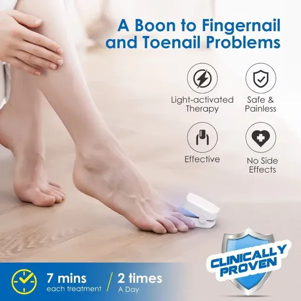 Oveallgo™ PROMAX forradalmi, nagy hatékonyságú fényterápiás eszköz lábkörömbetegségek kezelésére