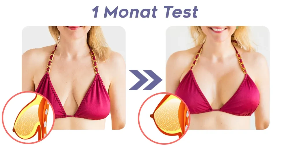 GFOUK™️ Massageador elétrico de busto BlossomUp