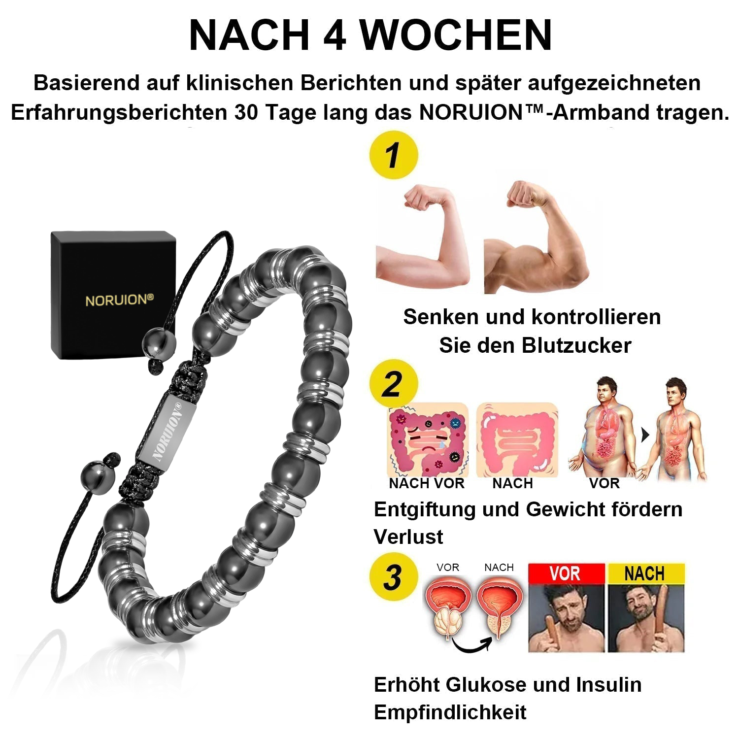 ❤️‍🔥 Pulseira de hematita magnética NORUION® 🌟 