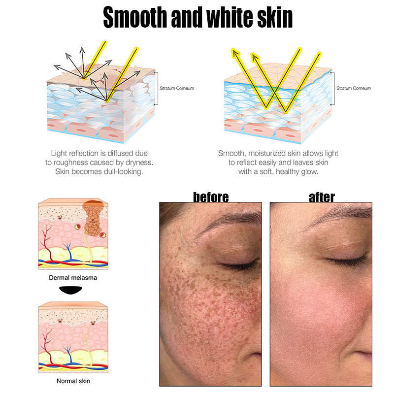 LOVILDS™𝐆𝐨𝐥𝐝 𝐂𝐥𝐨𝐢𝐬𝐨𝐧𝐧é 𝐄𝐧𝐚𝐦𝐞𝐥 𝐁𝐫𝐚𝐜𝐞𝐥𝐞𝐭 🔥 𝐋𝐲𝐦𝐩𝐡𝐚𝐭𝐢𝐜 𝐌𝐚𝐠𝐧𝐞𝐭𝐢𝐜 𝐓𝐡𝐞𝐫𝐚𝐩𝐲💎