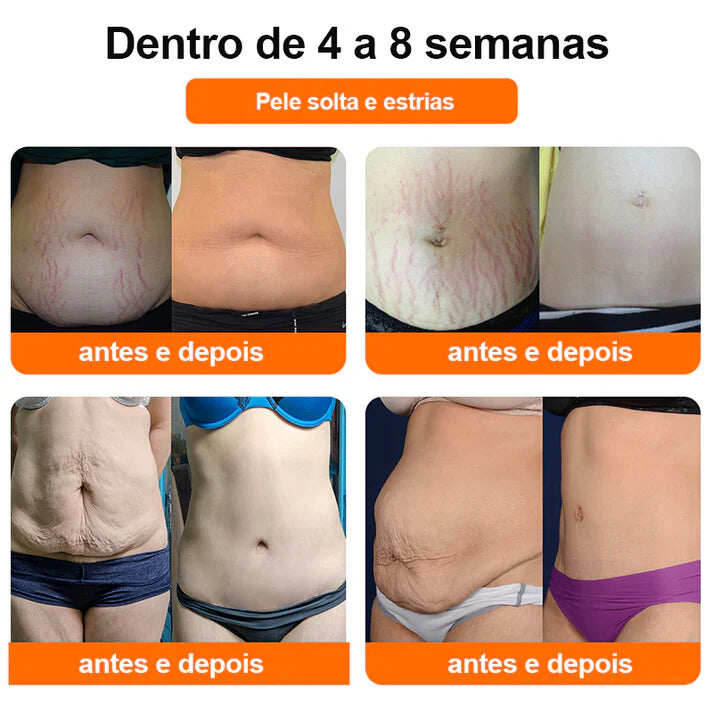 🔥💎Tecnologia 5D [promoção por tempo limitado] 2024 Nova versão Kaala™ Original Ceramic Ice Ionic Fiber Repair Styler