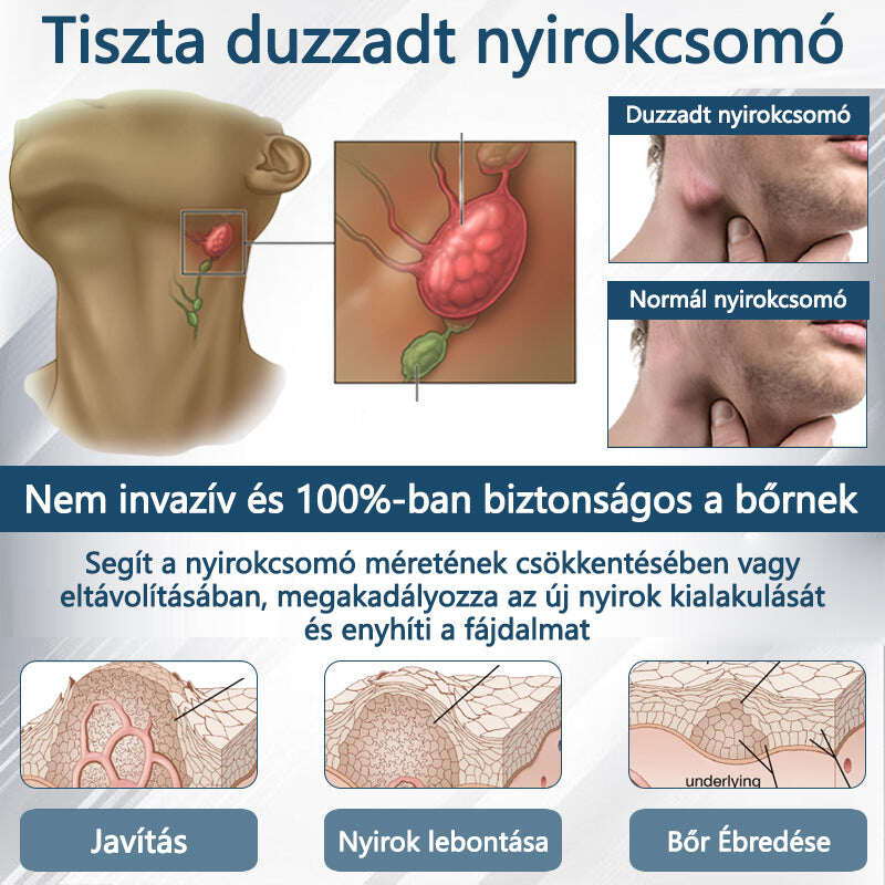 Cvreoz® Fekete kömény Ödéma méregtelenítő gyógynövénykrém💙