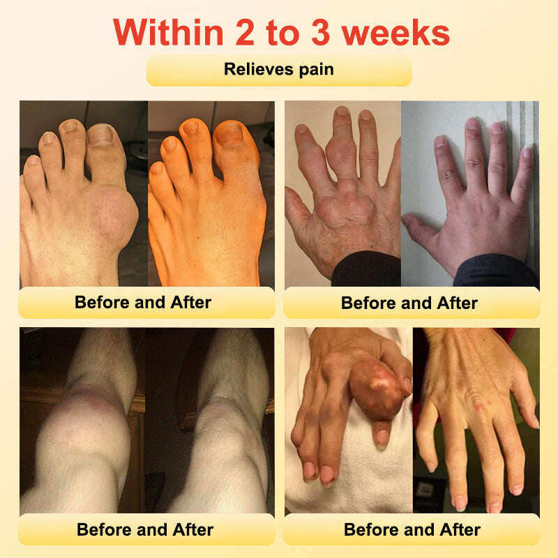 Гривна за здраве CZTICLE™ (ограничена във времето отстъпка🔥 последен ден)