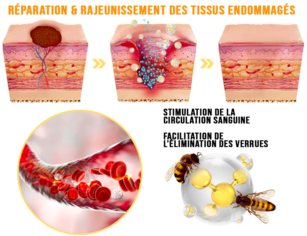 Spray de tratamento com veneno de abelha (para todas as anormalidades da pele)