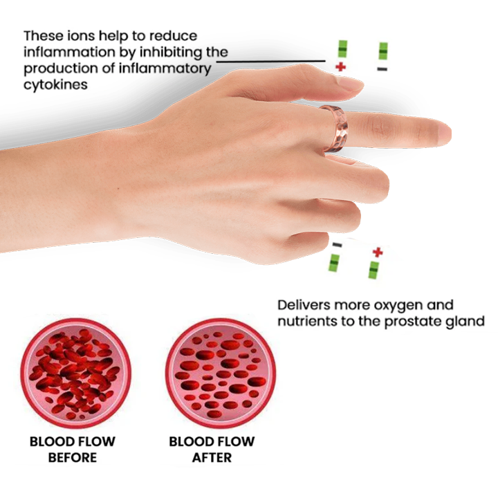 Пръстен за облекчаване на простатата Oveallgo™ MagnaCopper
