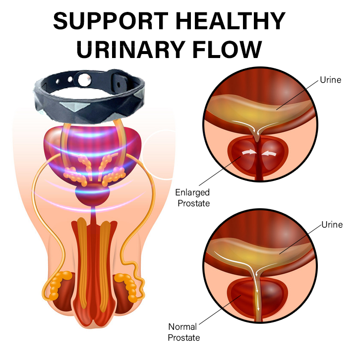 Oveallgo™ RedUp йонна терапия за облекчаване на простатата
