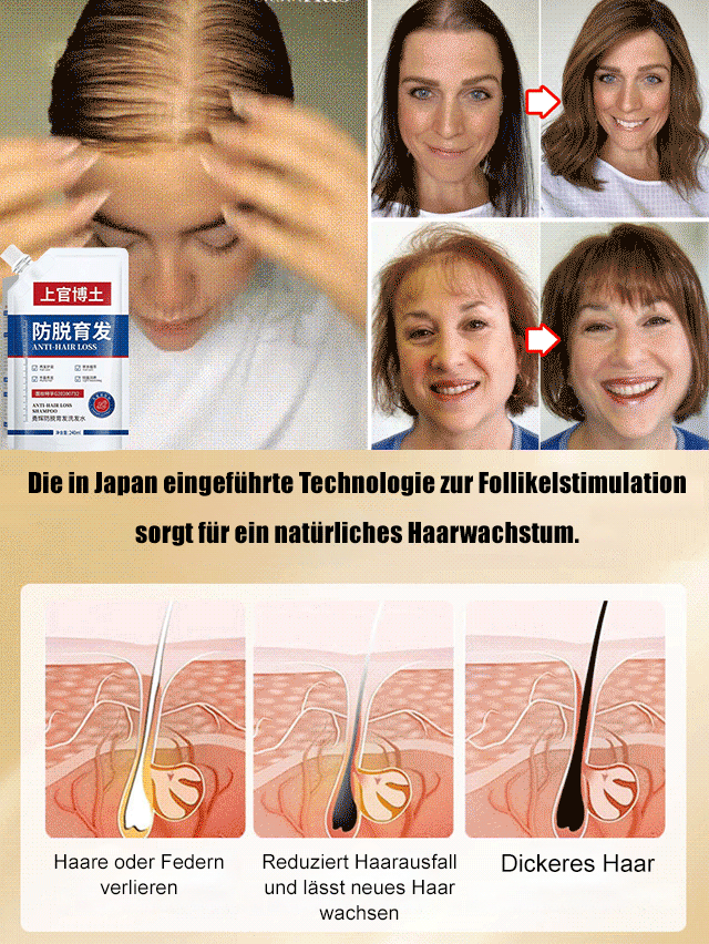 Шампоан против косопад